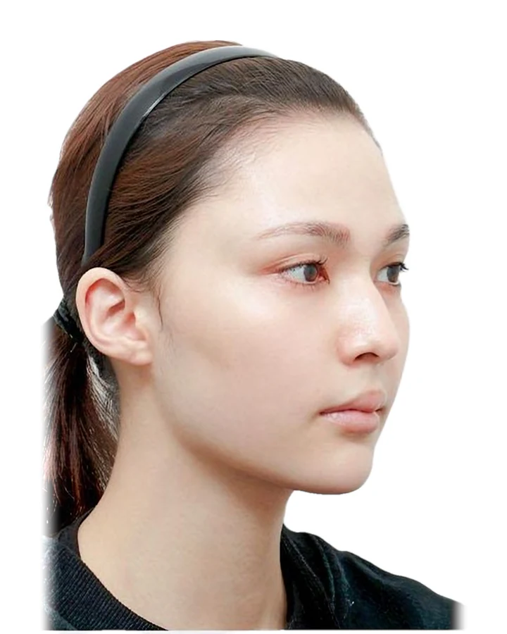 CASE 02 측면 수술 전