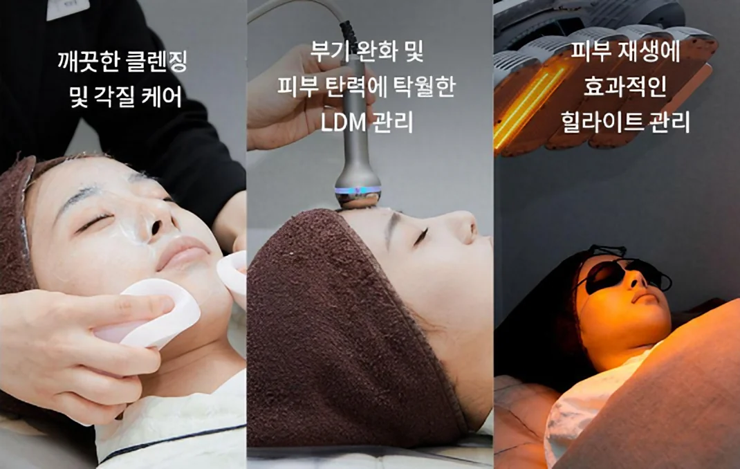 클렌징·각질 케어, LDM 관리, 힐라이트 관리